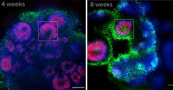 Brain (cerebral) organoids