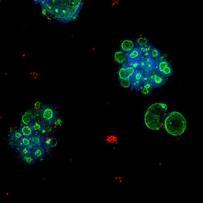 Colorectal organoids