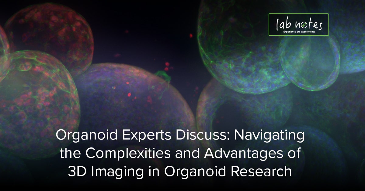 Organoid Experts Discuss: Navigating the Complexities and Advantages of ...