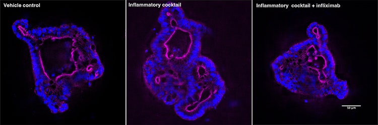 High magnification confocal images of human rectal organoids exposed to pro-inflammatory cytokines