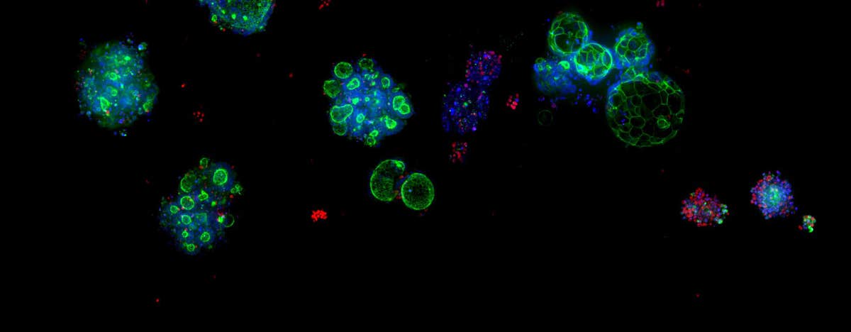 Assay-ready Patient-derived organoids (PDOs) and High-throughput 3D Imaging  to Drug Discovery