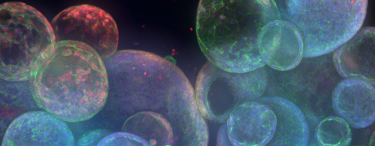 3D Imaging in Organoid Research