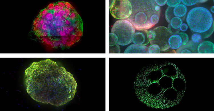 Examples of 3D cell models from the top left - brain organoid, lung organoids, cardioid (heart organoid), and 3D liver model.