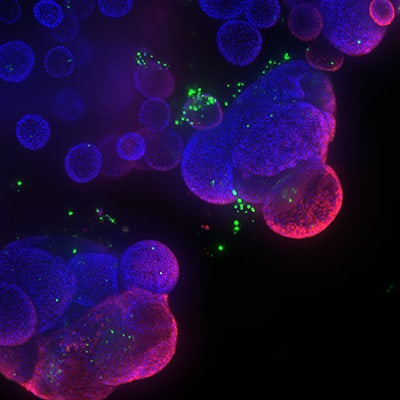 Lung organoid