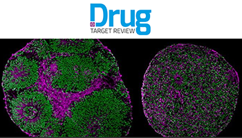 Patient-derived Organoids In Disease Modeling