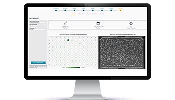 QPix Insights - Automated Microbial Colony Picking