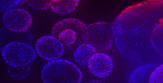 Organoids (3D) multi-cellular microtissues