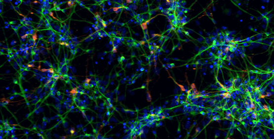 Pluripotent stem cells