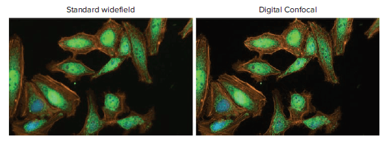 Confocal Vs Widefield